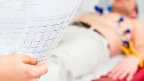 Eletrocardiograma (ECG de Repouso / Convencional / 12 Derivações)